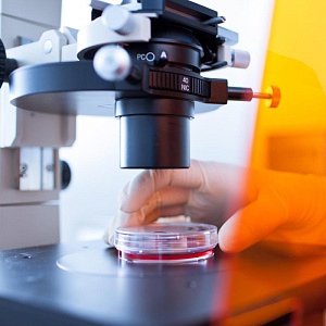 Лаборант кладет стекло с реагентом под микроскоп