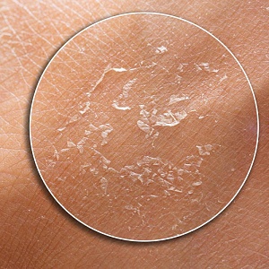 Дерматовенерология (144ч)