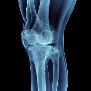 Эндопротезирование крупных суставов- 36 ч.