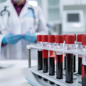 Клеточный состав крови под микроскопом